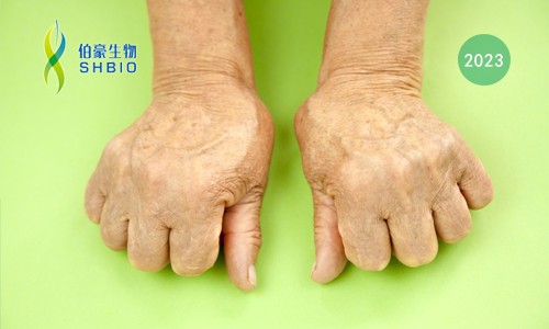 高分文獻(xiàn)一作分享會 | 時空組學(xué)技術(shù)助力發(fā)現(xiàn)類風(fēng)濕關(guān)節(jié)炎疾病治療新靶點